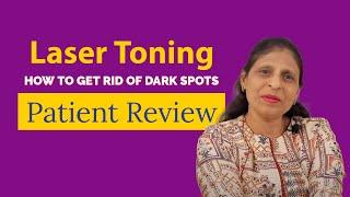 How to get rid of Dark spots or hyper pigmentation | Laser Toning | Dr. Jyoti Gupta MD