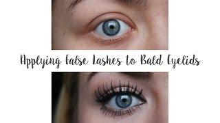 Applying False Lashes to Bald Eyelids (Trichotillomania) | G Beauty