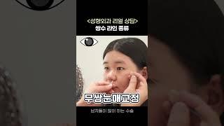 Double Eyelid Types in Real Time!