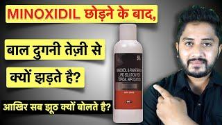 Minoxidil ke Side Effects. Is it Safe to Use Minoxidil?