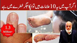 10 Signs Your Liver is in Danger | Lecture 91