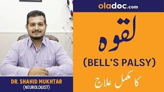 Laqwa ka Ilaj How to Treat Bells Palsy-What is Bells Palsy Lakwa Kya Hai Urdu Hindi-Palsy Exercises