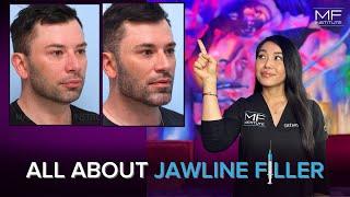 What Does Jawline Filler Do? | Mabrie Facial Institute in San Francisco