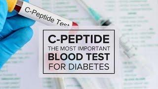 C-Peptide – The Most Important Blood Test for Diabetes