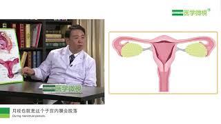 閉經是怎麼回事？What is amenorrhea?