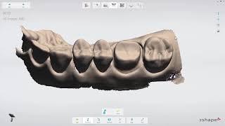 3DBioCAD - 3Shape TRIOS  Crown Workflow