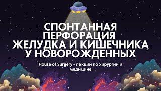 Спонтанная перфорация желудка и кишечника у новорожденных | Классификация | Диагностика | Лечение