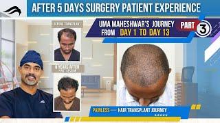 Hair Transplant In Chennai | Best Clinic Center Cost & Results Of Hair Transplant Of Chennai