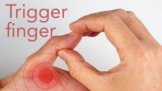 Trigger finger  complete blockage of the thumb  before and after the surgery (enable subtitles)