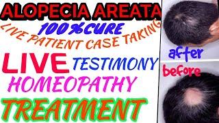 ALOPECIA AREATA|PATCHY HSIR LOSS|HOMEOPATHY TREATMENT|DISCUSSION BY drrajeshmanghnani EHOMEOVISION