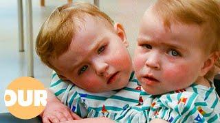 Katie and Eilish: The Unbreakable Bond of Conjoined Twins | Our Life