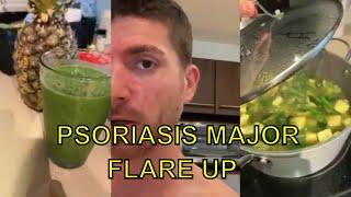 Psoriasis Flare Up - Diet, Biologics, Trip, Creams, Massages - Nothing Works!