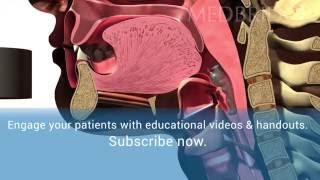 Normal Swallow Video - Patient Education | MedBridge