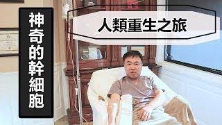 ‍️余亞暻說醫美 | Dr. Yu 余亞暻醫生親自接受幹細胞治療實錄！