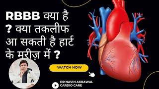 RBBB/LBBB क्या है?क्या तकलीफ आ सकती है हार्ट के मरीज़ में"Decoding RBBB/LBBB: Symptoms and Risks"