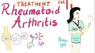 Rheumatoid Arthritis (Part 10): Management, Introduction