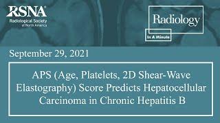 APS Score Predicts Hepatocellular Carcinoma in Chronic Hepatitis B