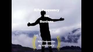 Bunions - Rife Frequency