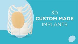 3D custom-made implant : Pectus Excavatum Treatment