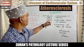 Systemic Pathology: Lecture 31 | Diseases of CVS : Day 01 -  Atherosclerosis