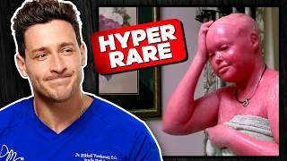 Doctor Reacts To Rarest Diseases