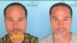 Treating Hair Loss - Inside South Florida CW w Dr Alan Bauman