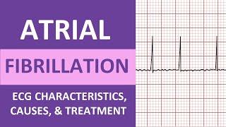 Atrial Fibrillation (A-Fib) ECG, Treatment, Causes, Nursing NCLEX Review ACLS