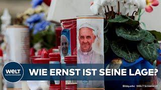 SORGE UM PAPST FRANZISKUS: Beatmungsmaske ab, doch Zustand bleibt ernst, Vatikan besorgt!