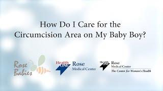 How Do I care for the Circumcision Area on My Baby Boy?