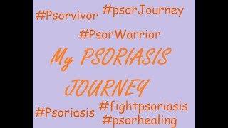 Psoriasis Vlog #001 | My Psoriasis Journey