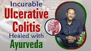 Incurable Ulcerative Colitis Healed with Ayurveda