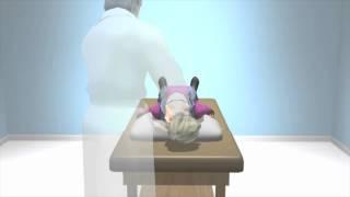 Dix Hallpike to Diagnose BPPV Dizziness