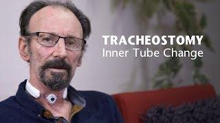 NHSGGC - Care of Tracheostomy: Inner Tube Change