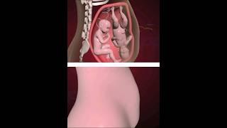 Precious Twins fight inside the Womb (3D animation )#youtubeshorts #shorts #Pregnancy