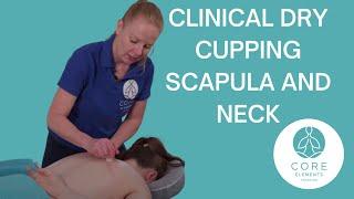 Clinical Dry Cupping Scapula & Neck - #drycupping techniques