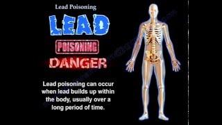 Lead Poisoning  - Everything You Need To Know - Dr. Nabil Ebraheim