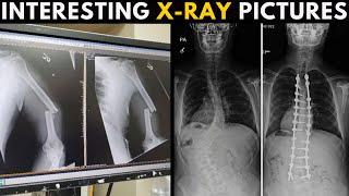 Weird Funny and Interesting X-Ray Results