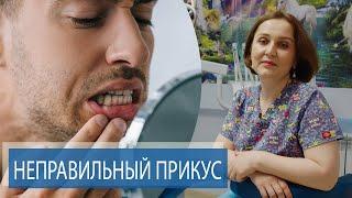 Неправильный прикус | СИМПТОМЫ