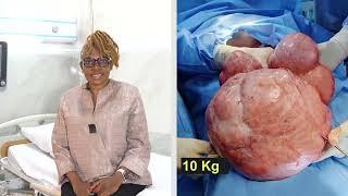 The Truth About Fibroid Surgery: UK Patient Shares Her Life-Changing Experience!