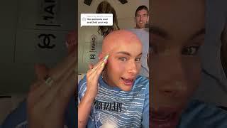 WIG SNATCH GONE WRONG #funny #comedy #bald #wigsnatch #alopecia #wigs