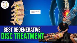 Top 3 Treatments for Degenerative Disc  Laser Therapy, Decompression, Cox Flexion Distraction