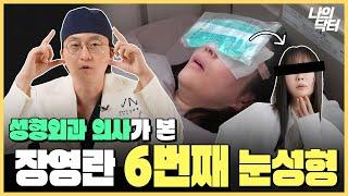 A급 장영란 또 눈성형하다? 6번째 눈성형을 본 성형외과 의사의 반응 - 닥터 김태훈