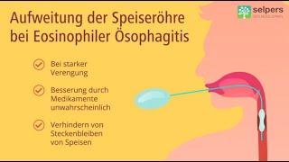 Aufweitung der Speiseröhre bei Eosinophiler Ösophagitis (Arzt erklärt)