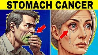 8 Strange Signs of STOMACH CANCER (Symptoms of Gastric Cancer)