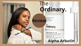 Watch this Before you buy: Alpha Arbutin The Ordinary ⎜Alpha Arbutin vs Hydroquinone ⎜Dark spots