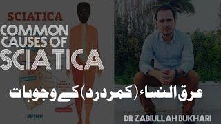 Common Causes of sciatica | Low back pain | Dr Zabiullah Bukhari | Physio Star