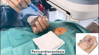 Pericardiocentesis