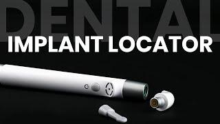 Dental Implant Locator: The #1 Mistake You Must Avoid!