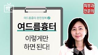 여드름흉터 이렇게만 하면된다! 여드름흉터 완전정복 2편!