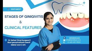 Stages of Gingivitis & Key Clinical Signs | Symptoms, Causes & Treatment